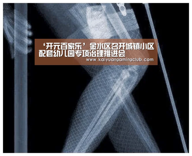 ‘开元百家乐’金水区召开城镇小区配套幼儿园专项治理推进会(图2) 开元直播